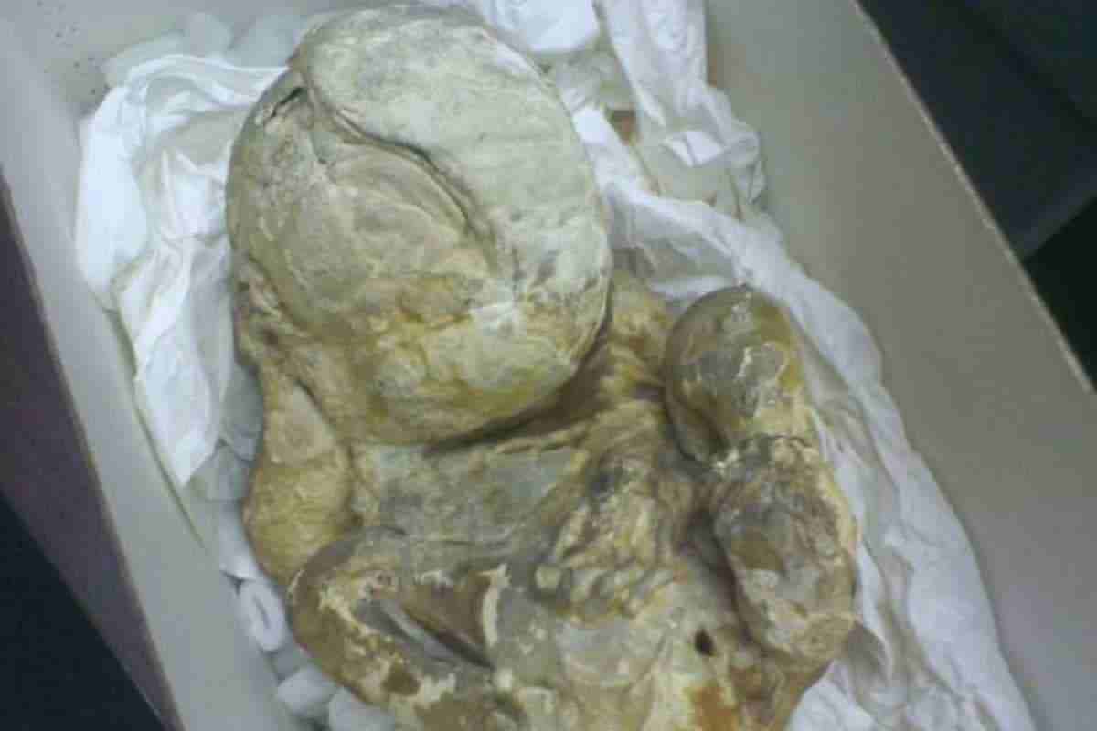 महिला ने जन्म दिया पत्थर का बच्चा woman gave birth to a stone child महिला को इसकी खबर तक नहीं थी महिला को जब पता चला तो पैरों तले जमीन खिसक गए